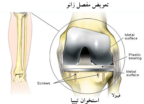 مفصل زانو