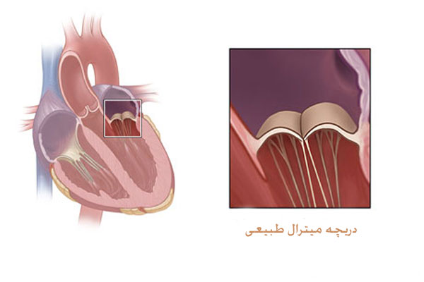 دریچه میترال سالم قلب