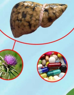 درمان گیاهی کبد چرب