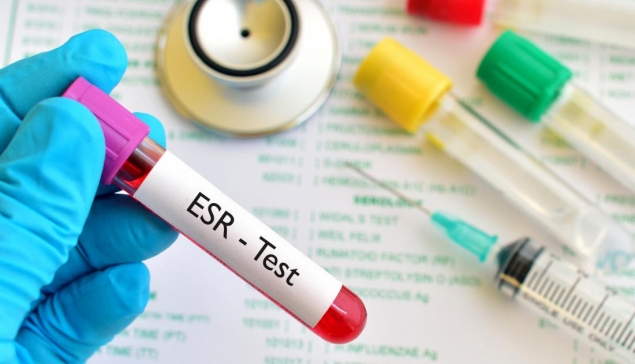تفسیر ESR
