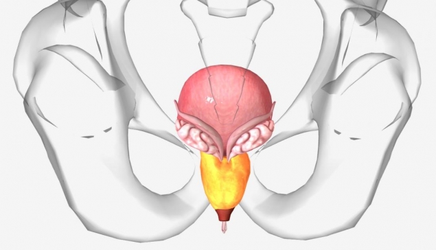 درمان بزرگی پروستات