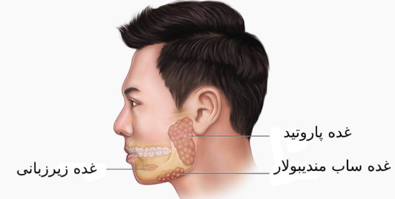 پاراتیدیت