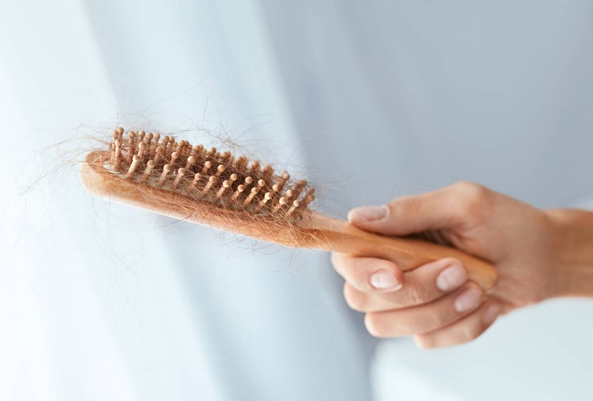 علل و درمان ریزش مو