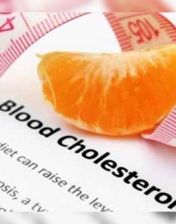 مواد غذایی برای افزایش کلسترول HDL