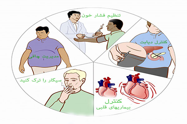 عاداتی برای جلوگیری از سکته مغزی