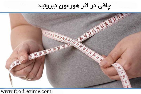 چاقی در کم کاری تیروئید