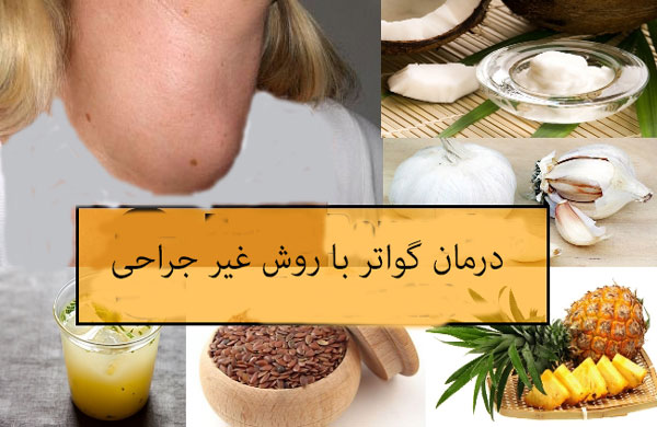 رژیم غذایی مناسب برای گواتر