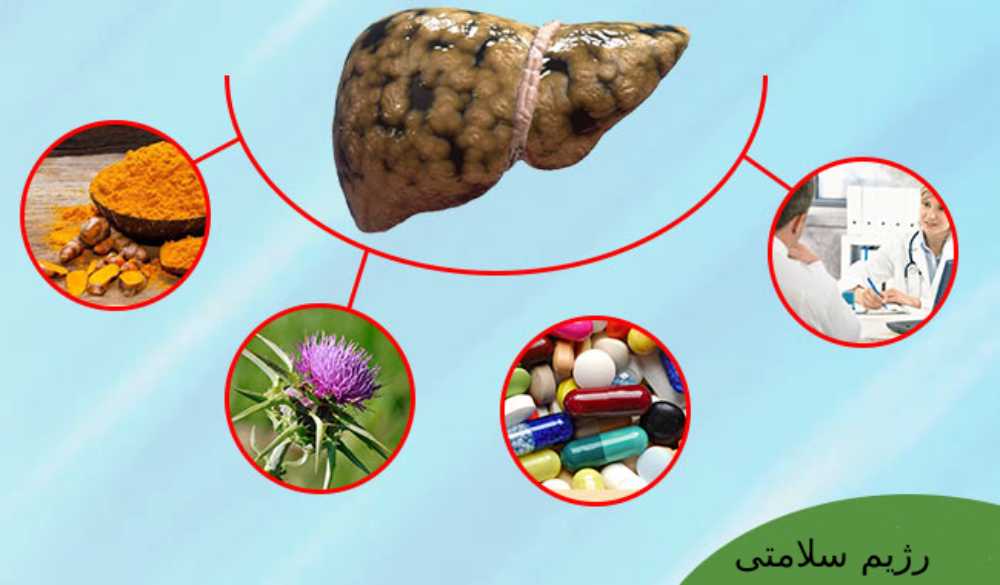 درمان گیاهی کبد چرب